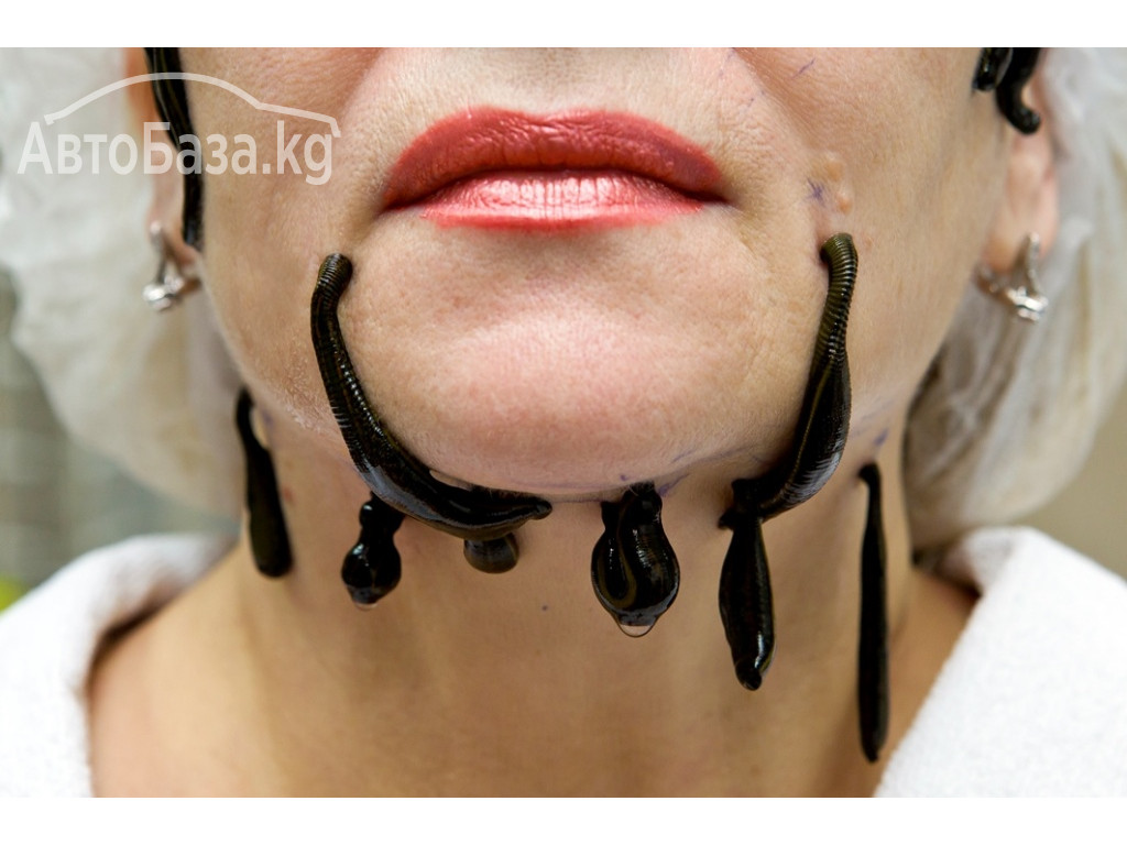 ВРАЧ - ГИРУДОТЕРАПЕВТ, СЕМЕЙНЫЙ ДОКТОР