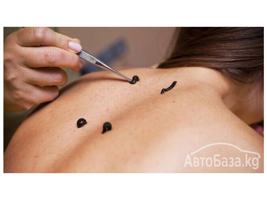 ВРАЧ - ГИРУДОТЕРАПЕВТ, СЕМЕЙНЫЙ ДОКТОР