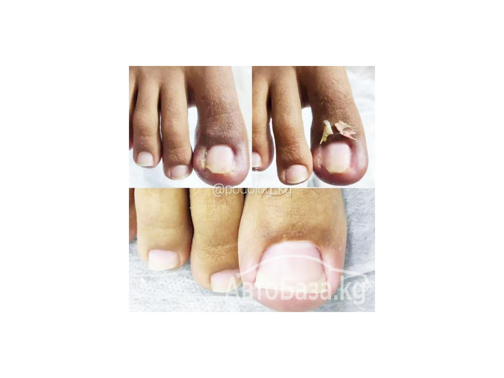 ПОДОЛОГ , Услуги Подолога