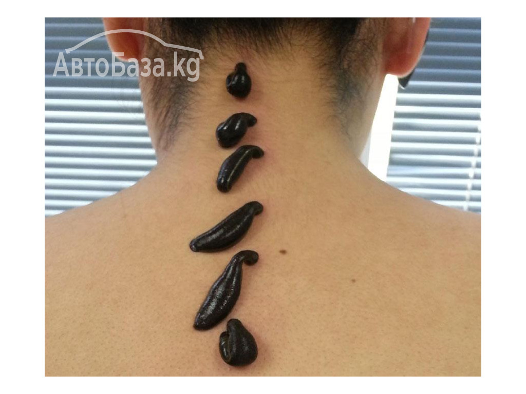 ВРАЧ - ГИРУДОТЕРАПЕВТ, СЕМЕЙНЫЙ ДОКТОР