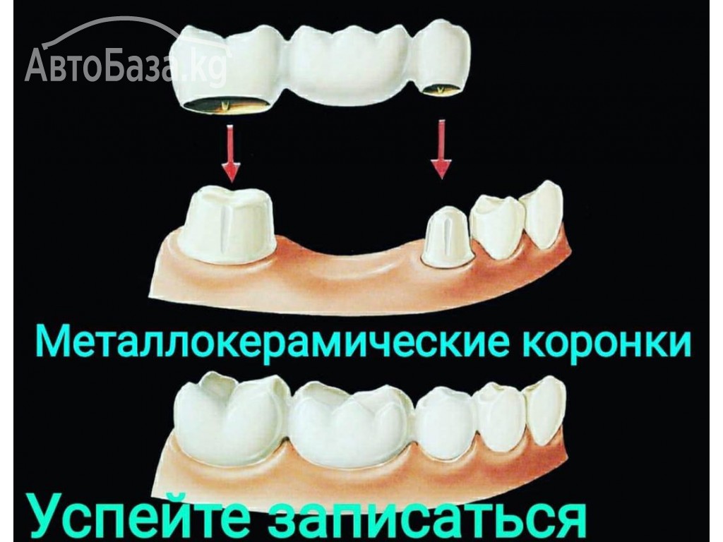 Все виды стоматологических услуг. Суйундуков Жоомарт Эсенбекович 