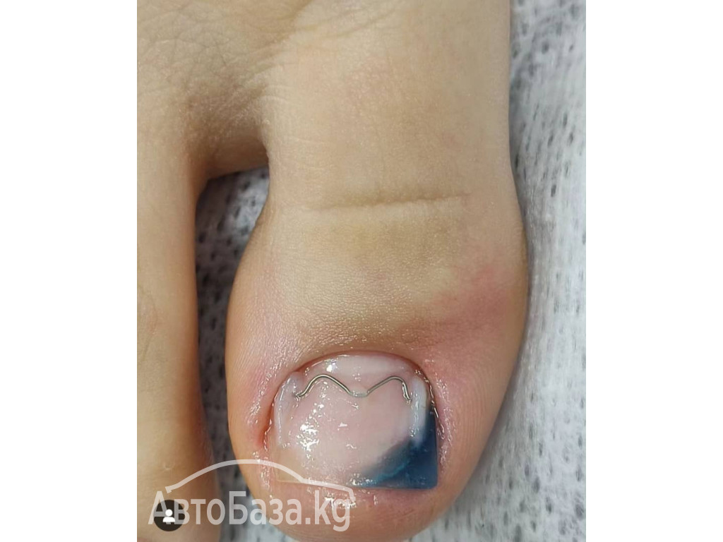 ПОДОЛОГ , Услуги Подолога