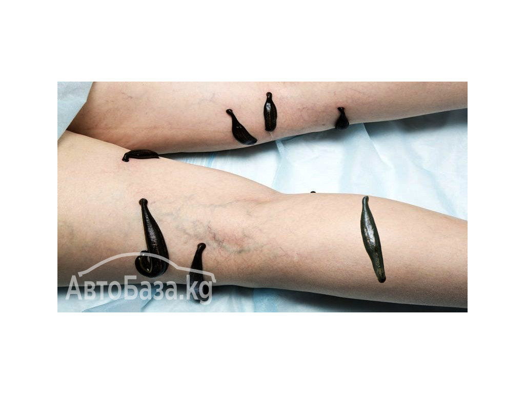 ВРАЧ - ГИРУДОТЕРАПЕВТ, СЕМЕЙНЫЙ ДОКТОР