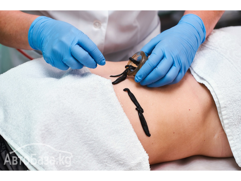 ВРАЧ - ГИРУДОТЕРАПЕВТ, СЕМЕЙНЫЙ ДОКТОР